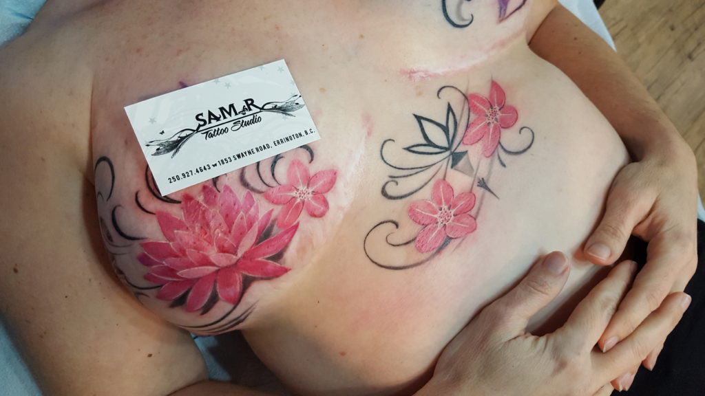 Mastectomy Tattooing